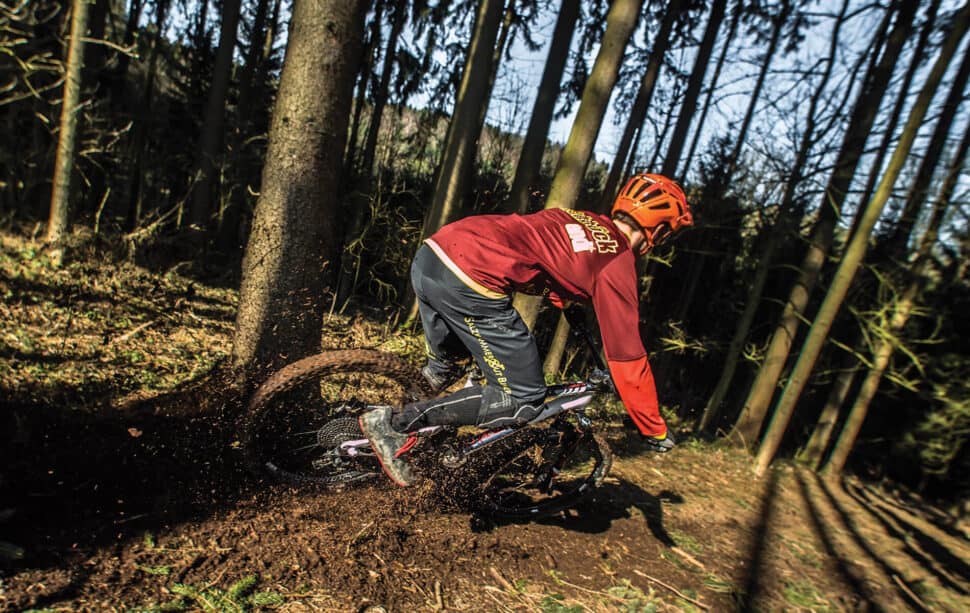 Culture: Scars Are Souvenirs On Your Bike And Body
